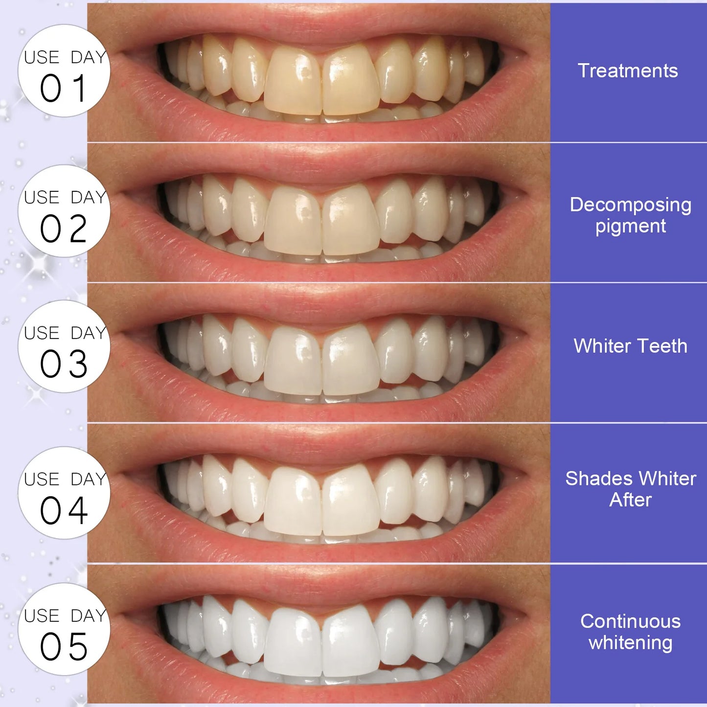 5D Teeth Whitening Strips