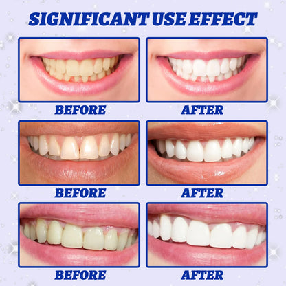5D Teeth Whitening Strips