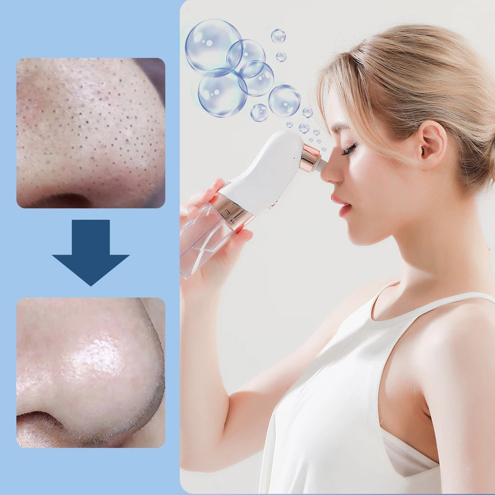 Electric Small Bubble Blackhead Remover