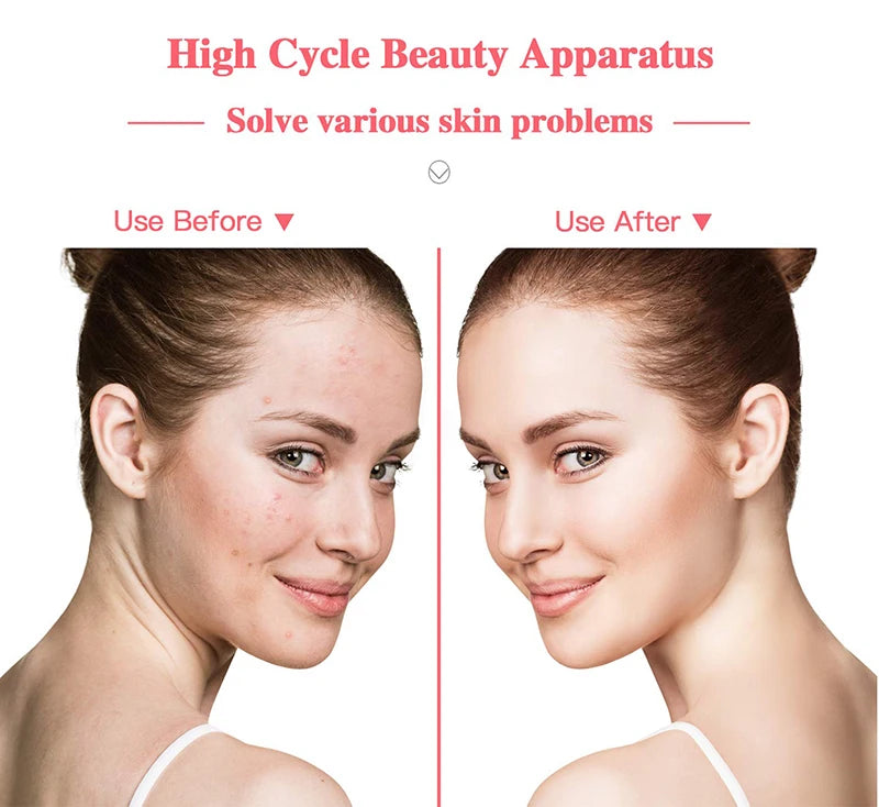 Portable Skin Therapy Wand