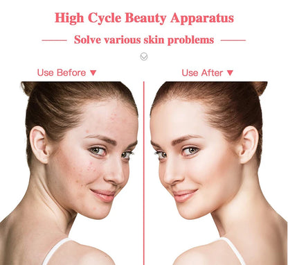 Portable Skin Therapy Wand