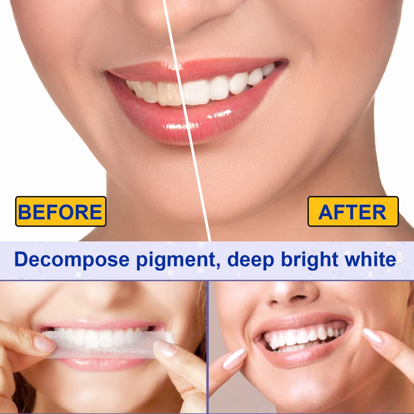 5D Teeth Whitening Strips