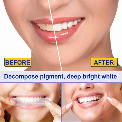 5D Teeth Whitening Strips