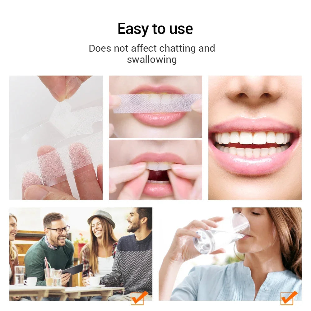 5D Teeth Whitening Strips